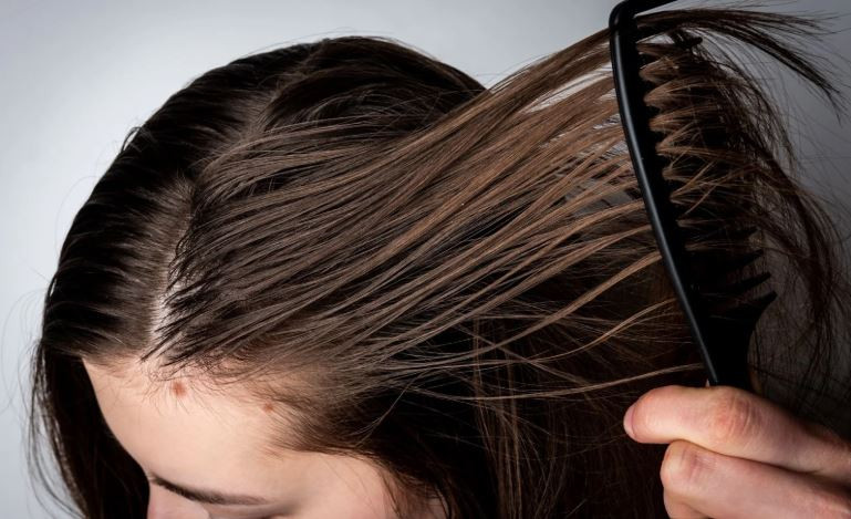 Oily scalp 